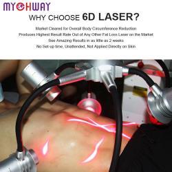 Система лазерной коррекции фигуры 