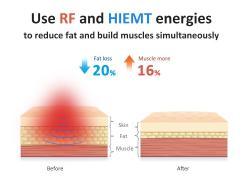 Стимулятор мышц с RF для похудения и груди 14 Тесла 4 ручки (арт. 25-19081459)