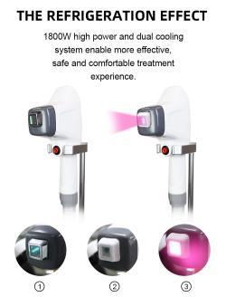 Лазерная машина для удаления тройной длины волны 755 808 1064 нм (арт. 25-19081532)