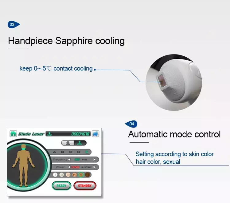 Аппарат для эпиляции тройной длины волны для тела и лица (арт. 25-19081678)