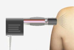 Аппарат ударно-волновой терапии 6 Бар для лечения ЭД (арт. 25-19081805)